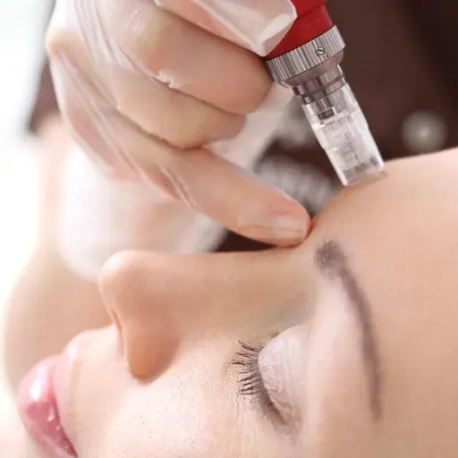 767: Microneedling: Moving the Needle in Skin Rejuvenation and Collagen Reproduction