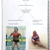  El Tintero: Lo que tienen en común una persona que sufre distrofia muscular y una atleta olímpica 