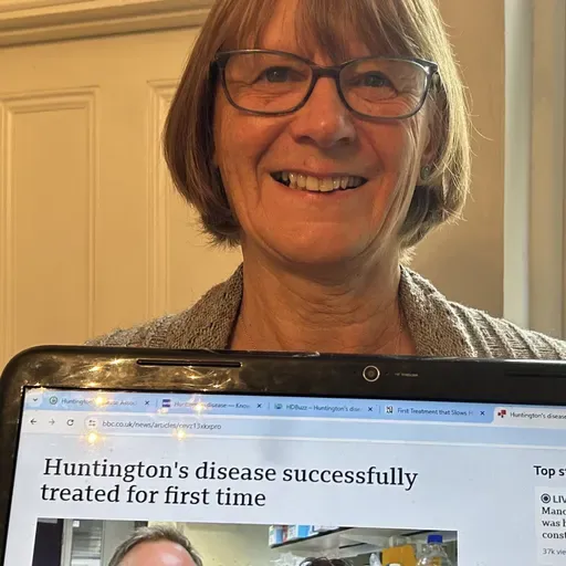 Huntington’s Disease treatment raises real hope of a cure