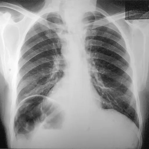 MEDIZINGESCHICHTEN - Weiße Kittel im Ost-West-Konflikt