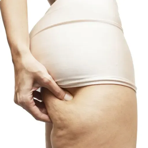 Bölüm 967: Selülit ve Septa İlişkisi