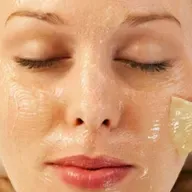 Peeling 