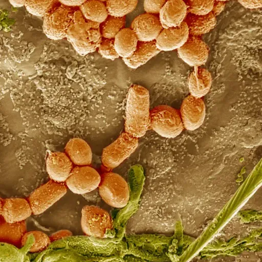 La microbiota: nuestro segundo cerebro