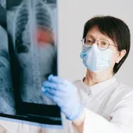 Ung thư phổi đứng thứ 2 về số ca tử vong trong các loại ung thư, vì sao?