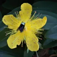 How do you know if you have dyscalculia?