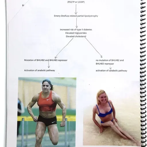  El Tintero: Lo que tienen en común una persona que sufre distrofia muscular y una atleta olímpica 