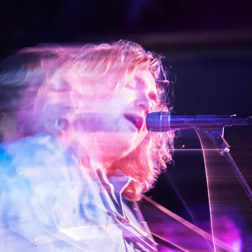 Deep Reads: A songwriter had part of his brain removed. The music flowed.