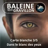 S05E123 Carte blanche 3/5 : Dans le blanc des yeux, c'est sclère et net